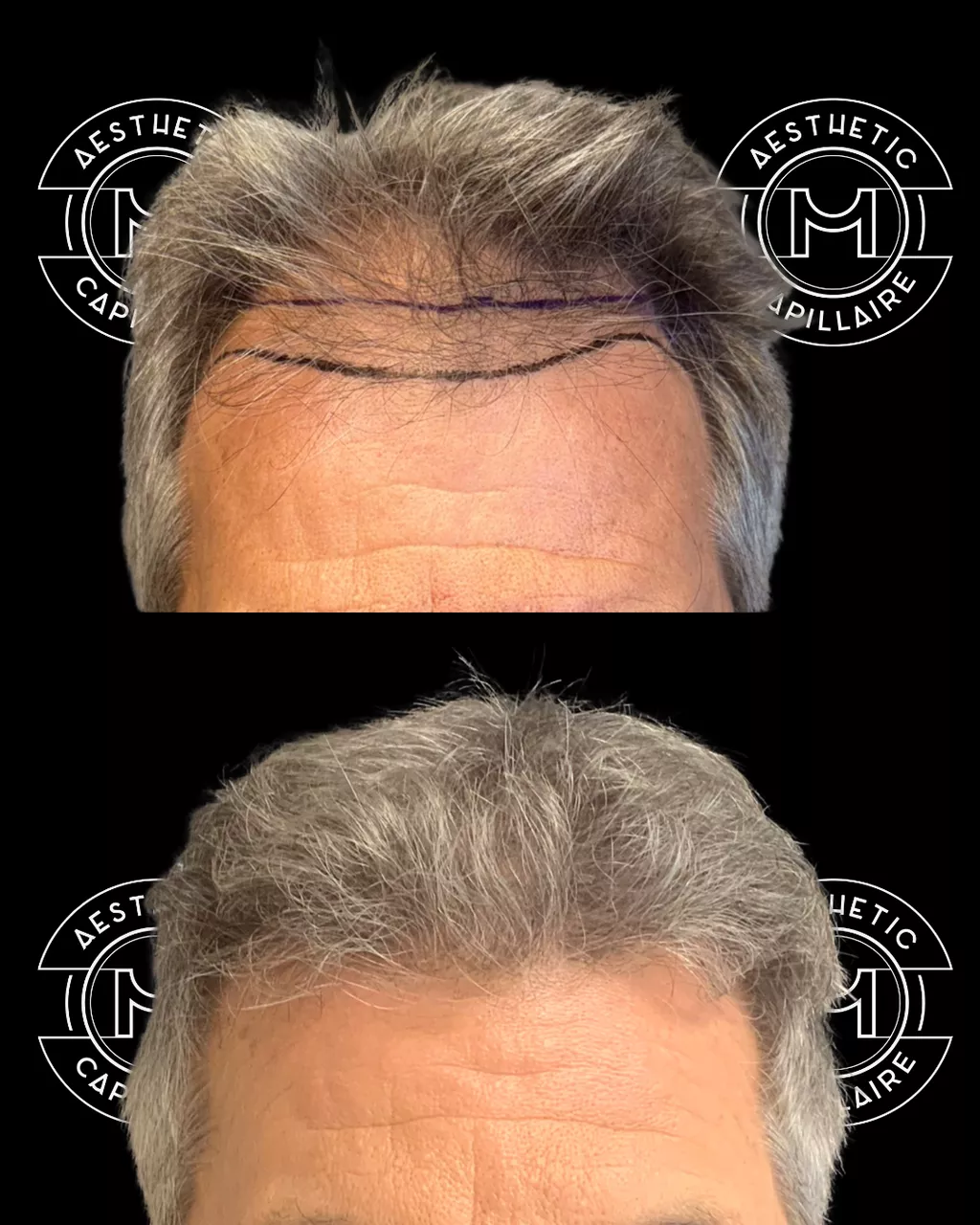 1. Un résultat indétectable et naturel