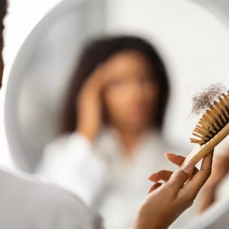 Greffe de cheveux chez la femme